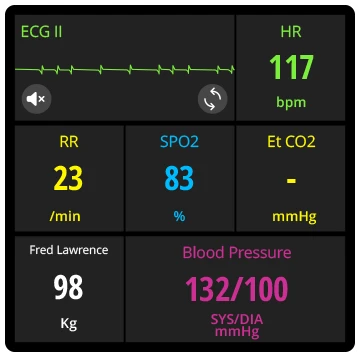 Monitor Vital Signs 1 Monitor Vital Signs